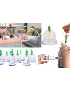 Chinese vacuum cupping set 2