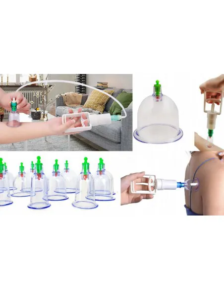Chinese vacuum cupping set